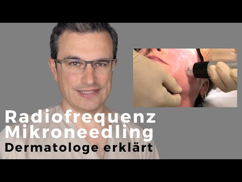 RADIOFREQUENZ MIKRONEEDLING mit dem Genius. DERMATOLOGE erklärt die Anwendung